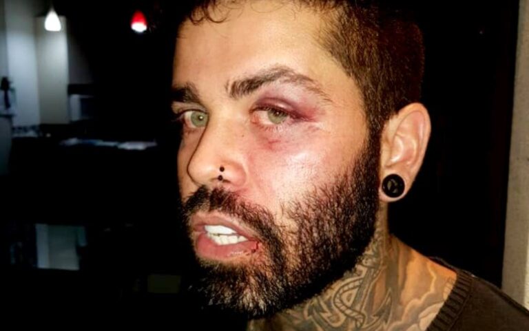 Cantor que denunciou ter sido agredido por PM para confessar furto de combustível é absolvido pela Justiça